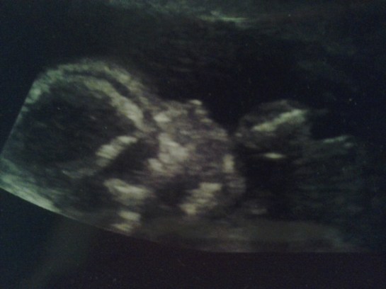 10015631_1458346611-6882_r